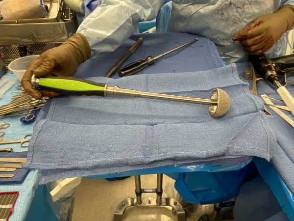 Cup hip replacement Cup hip replacement