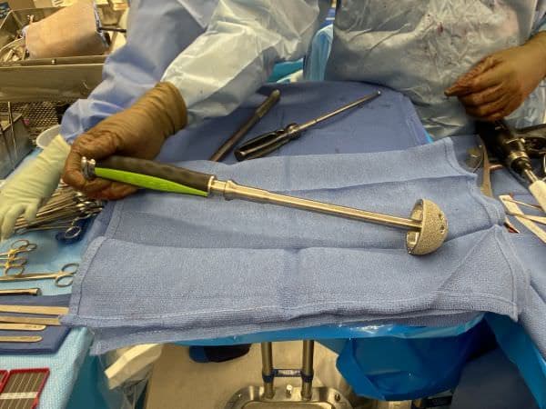 Cup hip replacement Cup hip replacement