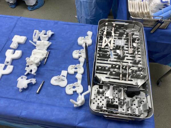 Custom knee replacement instruments Custom knee replacement instruments