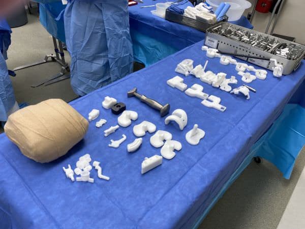 Custom knee replacement instruments Custom knee replacement instruments