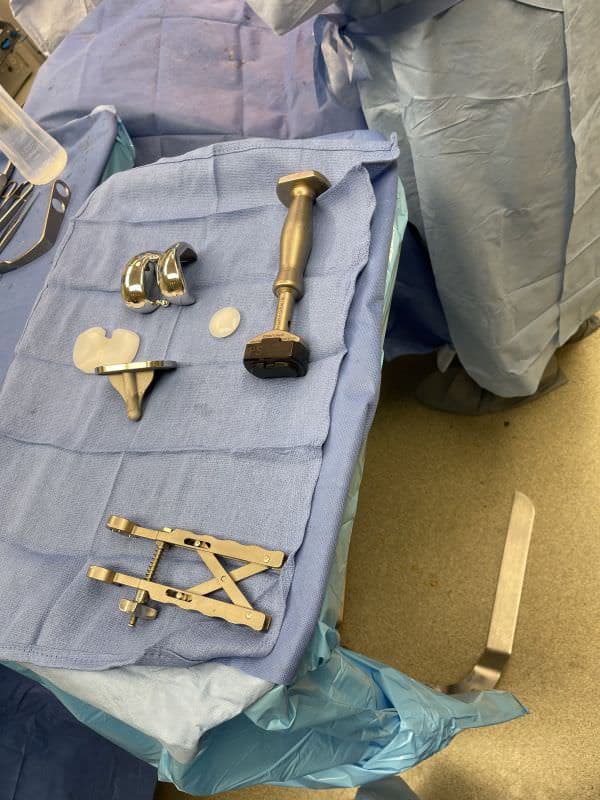 Custom knee replacement ready for implantation Custom knee replacement ready for implantation