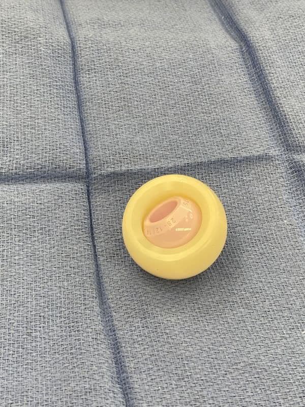 Dual mobility hip replacement Dual mobility hip replacement