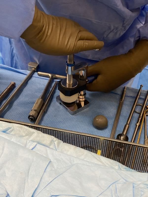 Dual mobility hip replacement 1 Dual mobility hip replacement