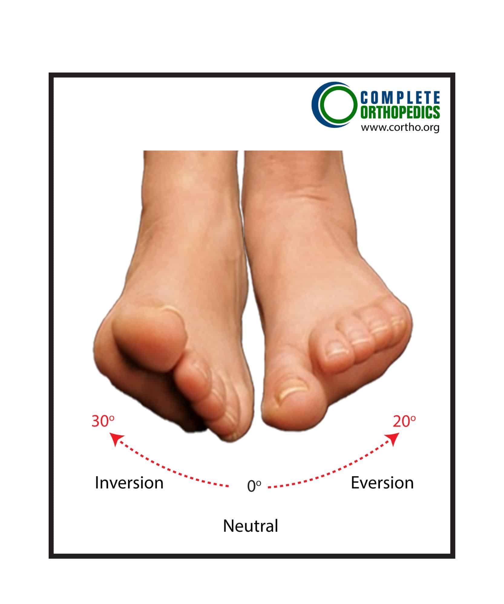 Figure: Subtalar Joint Motion Figure: Subtalar Joint Motion
