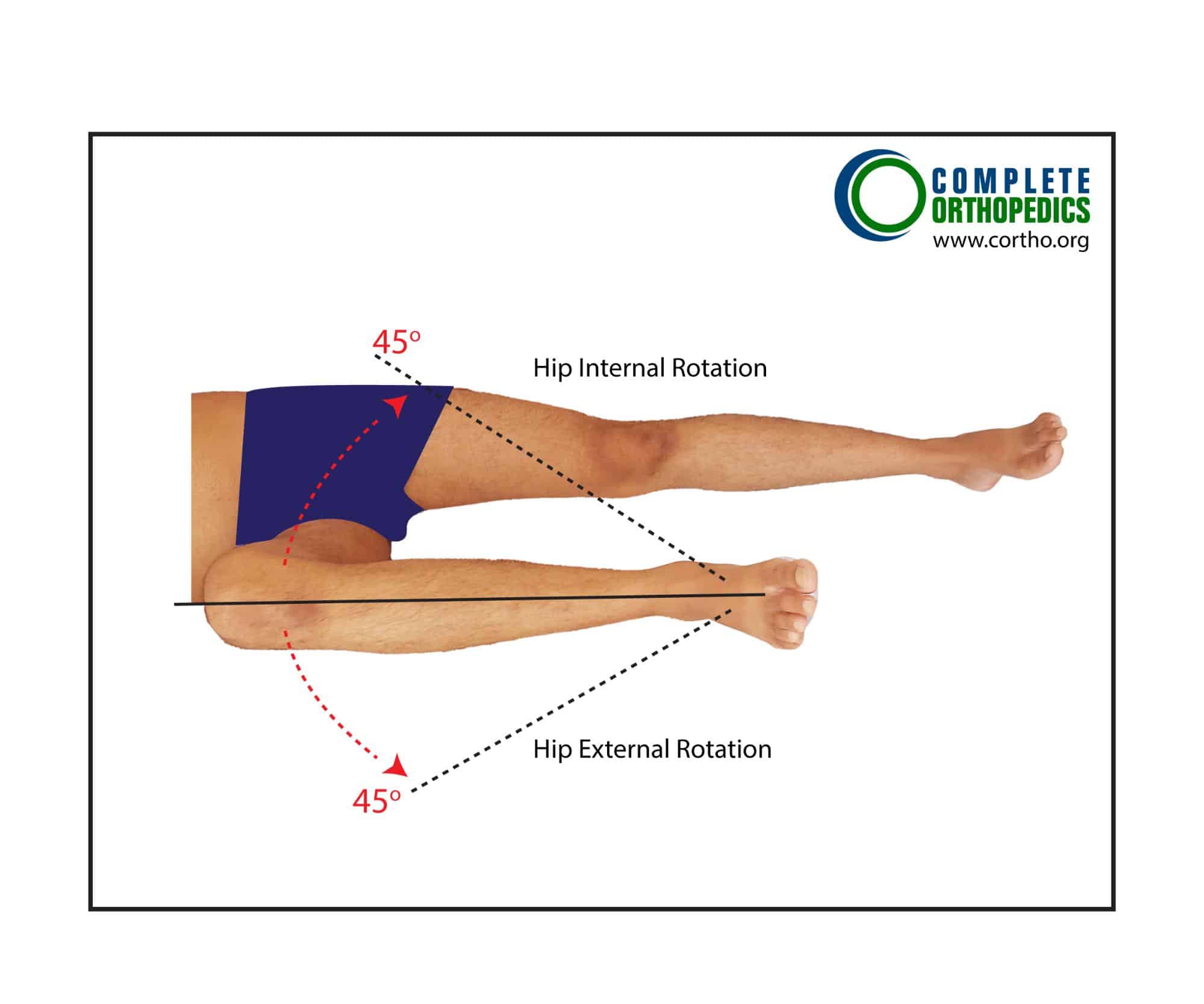 Figure: Hip Internal and External Rotation Figure: Hip Internal and External Rotation