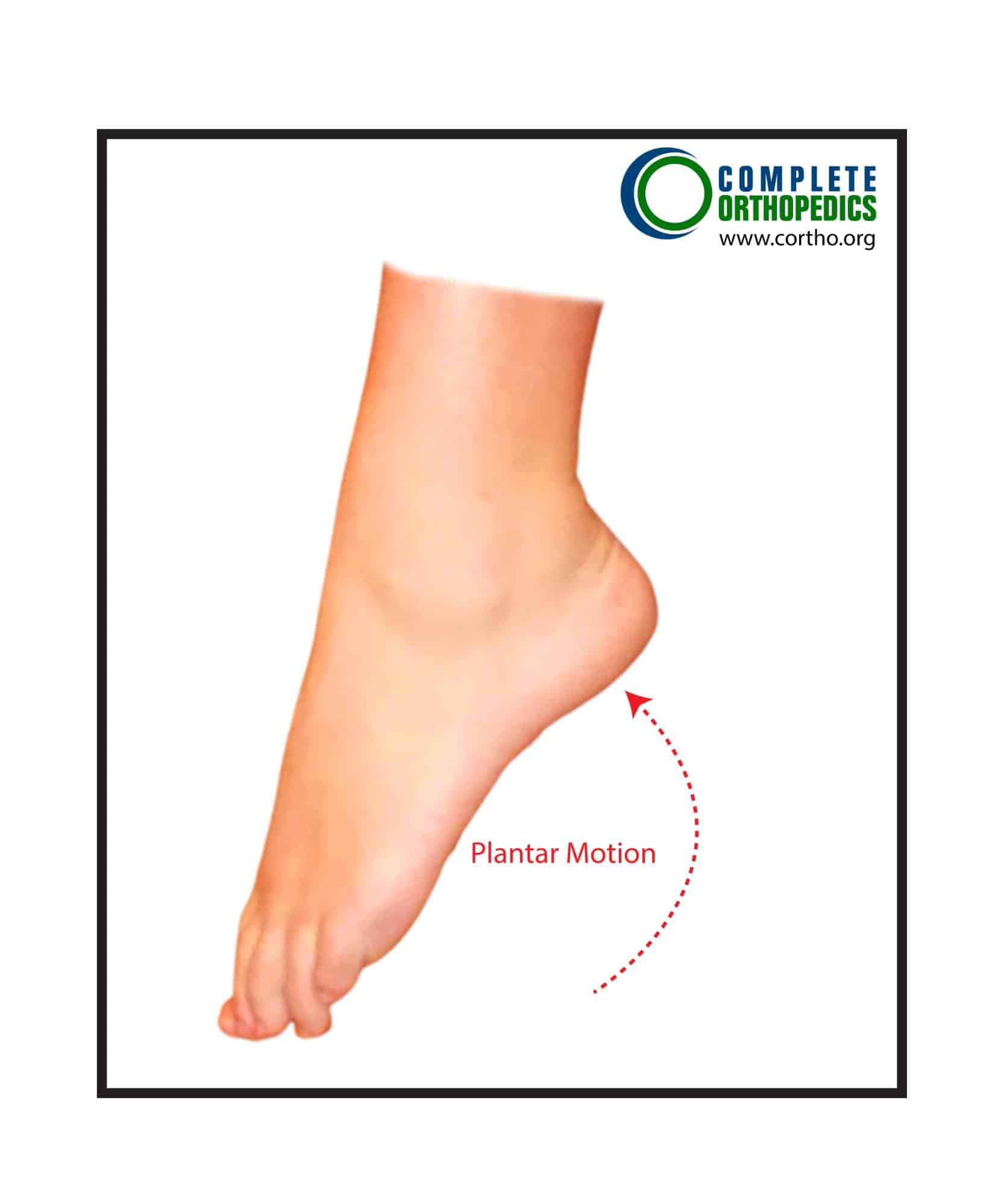 Figure: Plantar Motion Figure: Plantar Motion