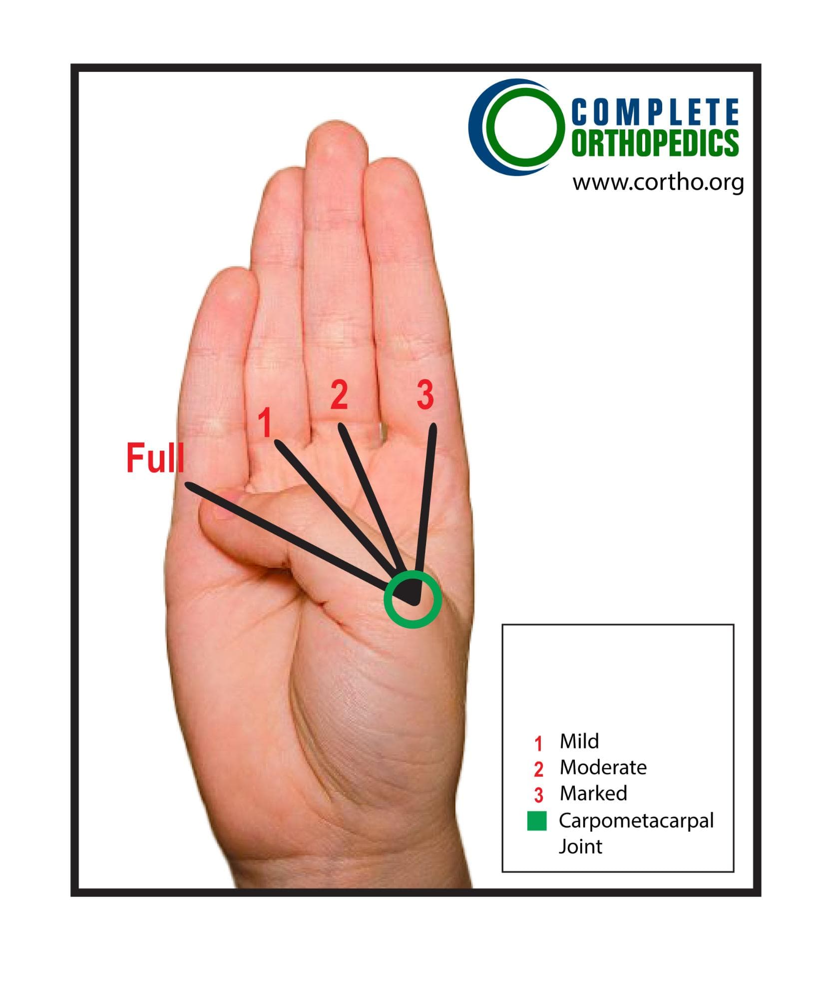 Radial Abduction Measurement Position