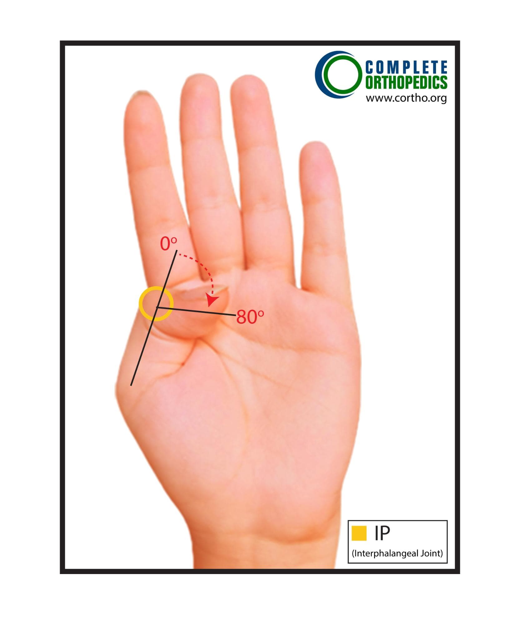 Measurement Position for Metacarpophalangeal Joint (MCP)