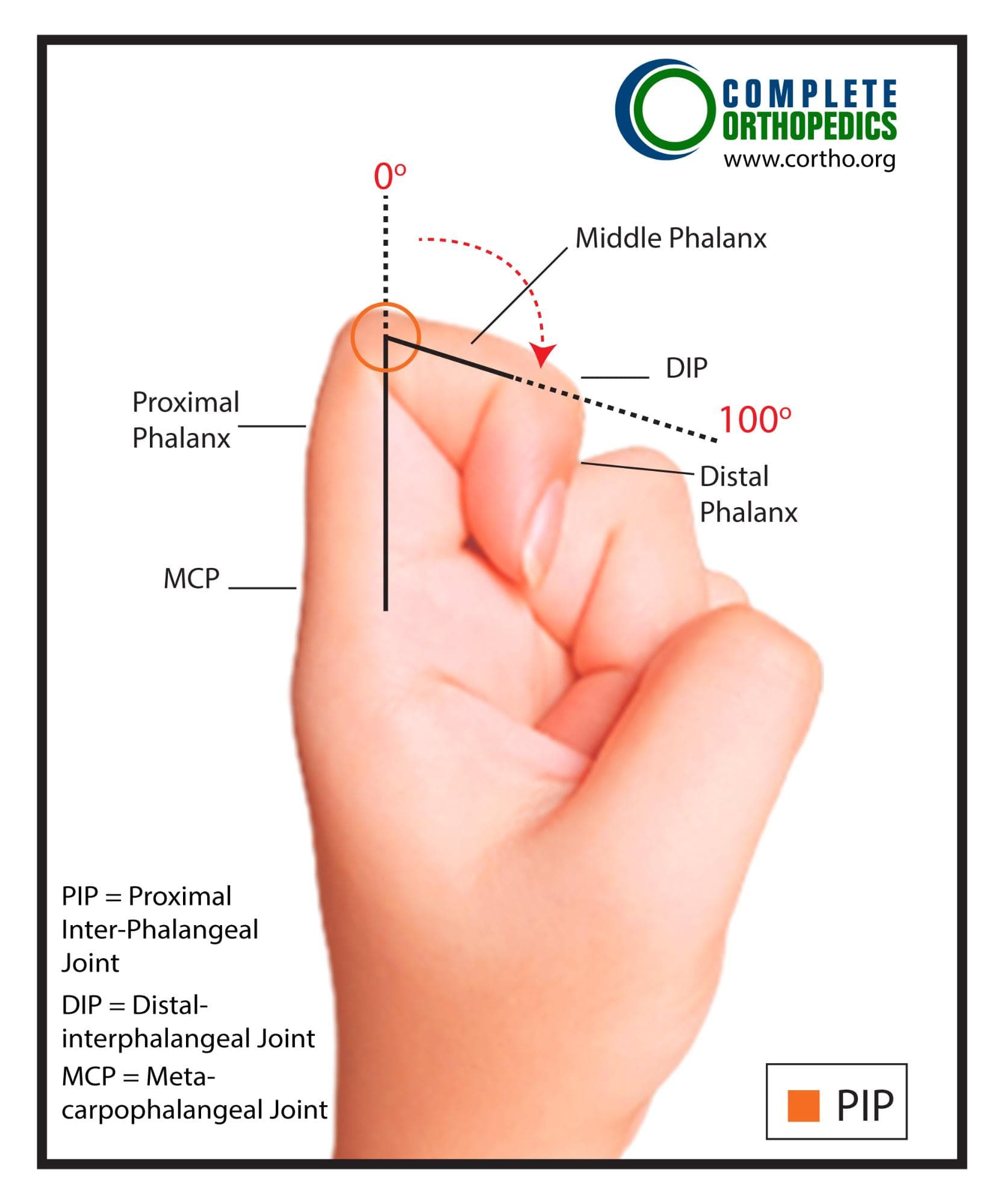 Metacarpophalangeal Joint (MCP) Measurement Position