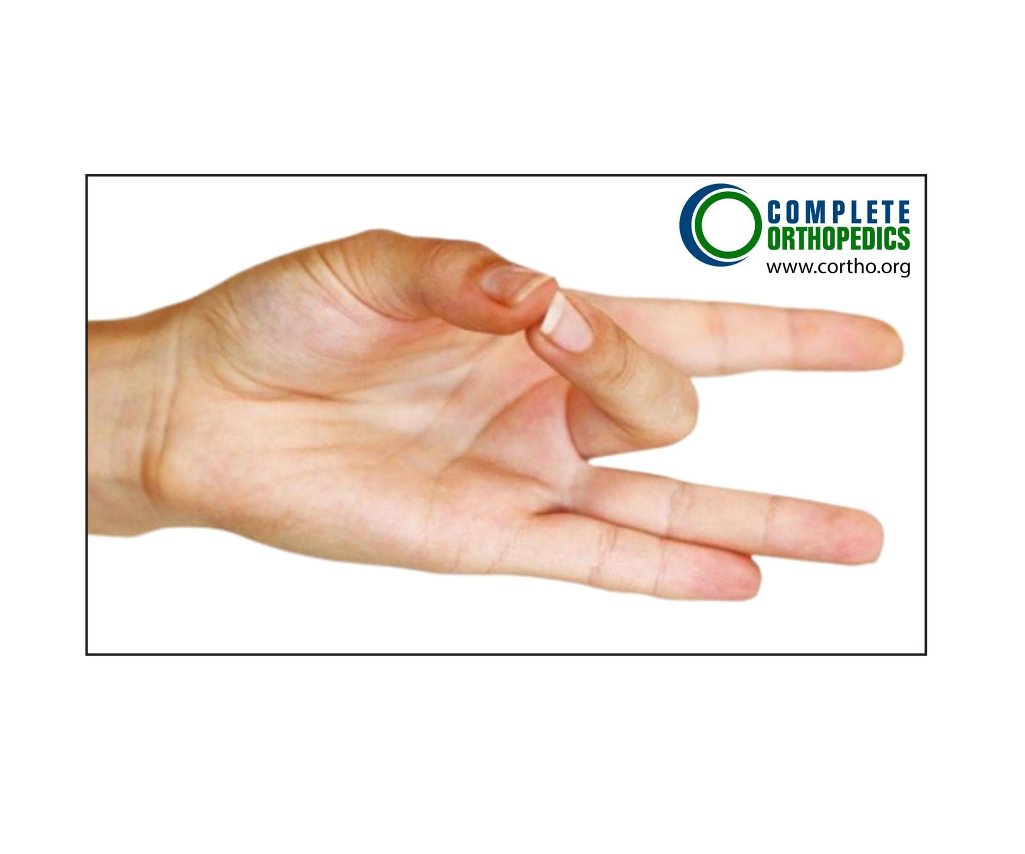 Calculating Loss of Use of Thumb