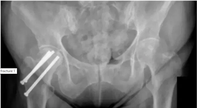 Étude de cas de matériel douloureux