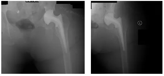 native hip 2 native hip 2