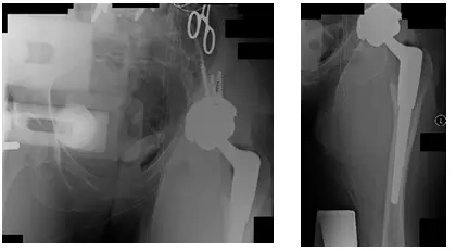 native hip 3 native hip 3