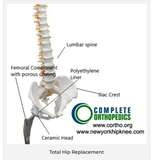 Spine and hip image Spine and hip image
