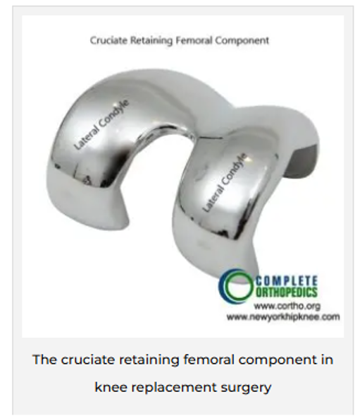 Cruciate-retaining femoral component Cruciate-retaining femoral component