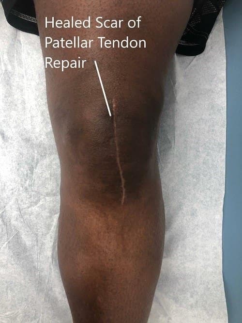 Postoperative images at 2 months follow up Postoperative images at 2 months follow up