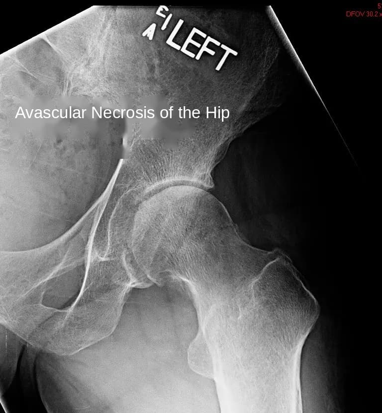 Preoperative X-ray 4 Preoperative X-ray 4