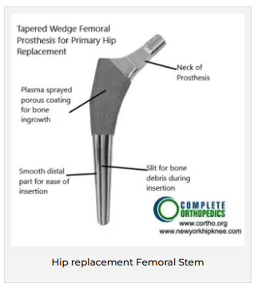 Tapered wedge stem Tapered wedge stem