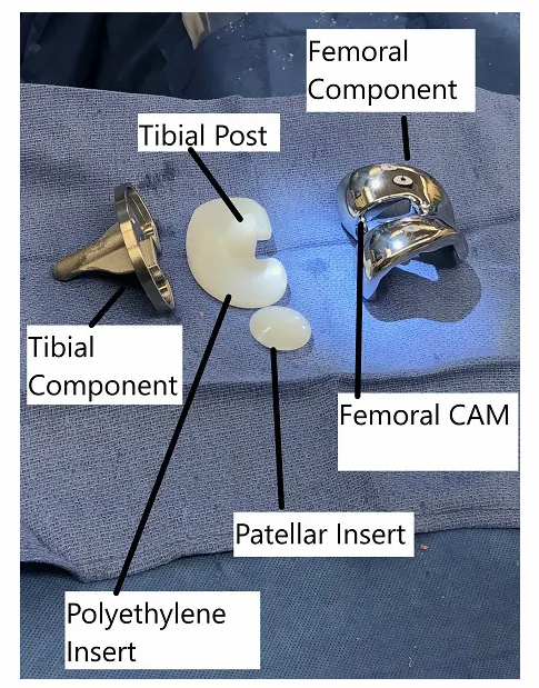 Total Knee Replacement Components 2 Total Knee Replacement Components 2