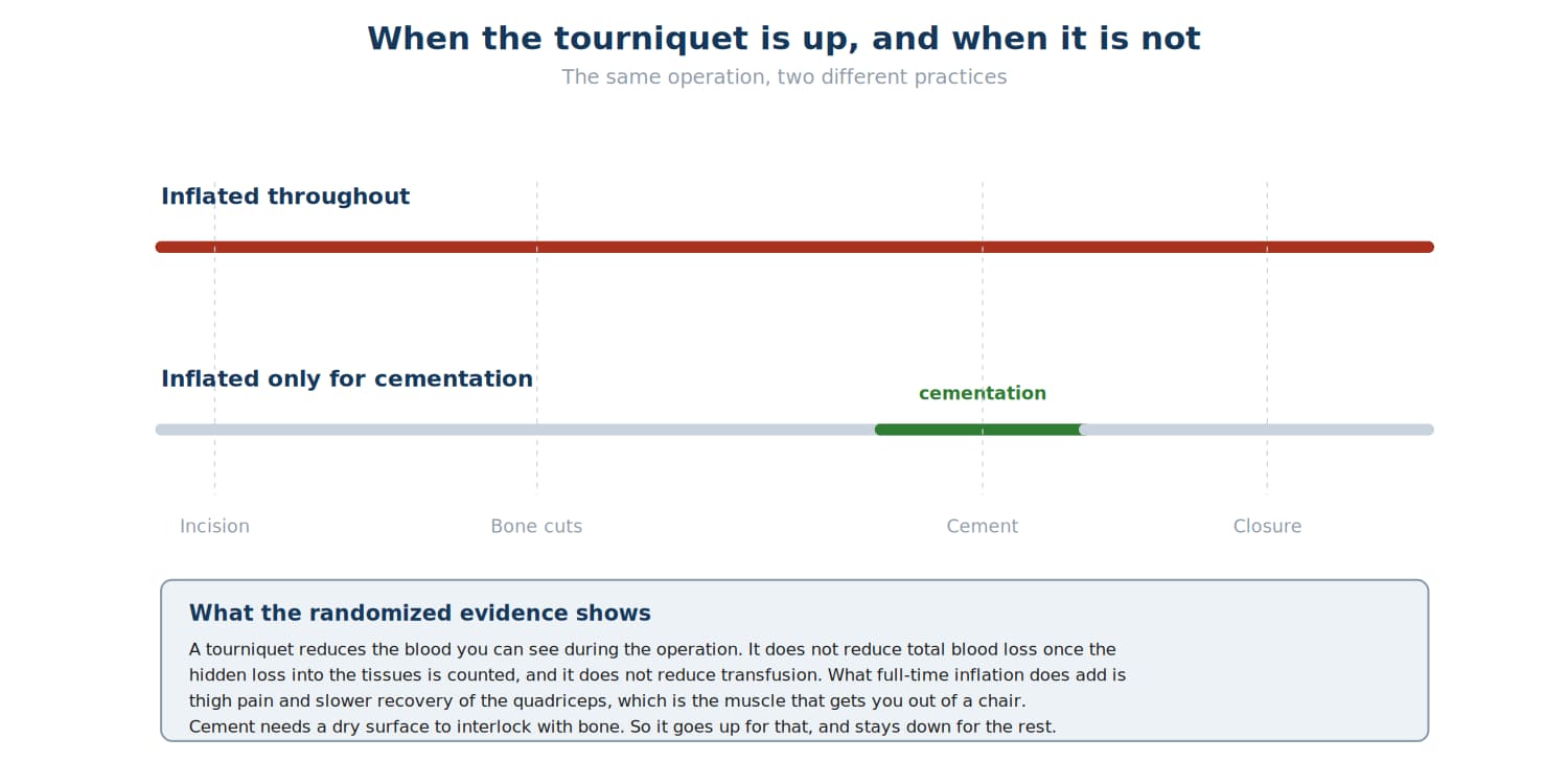 Tourniquet Tourniquet