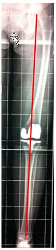 ct scan