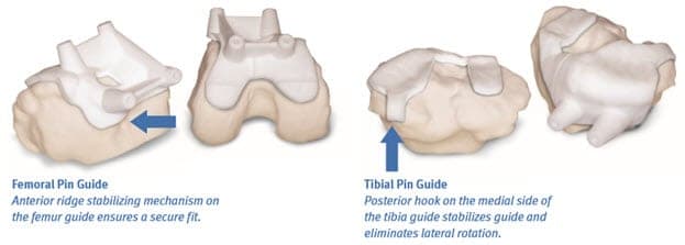 pin guide2 Femoral and Tibial Pin Guide